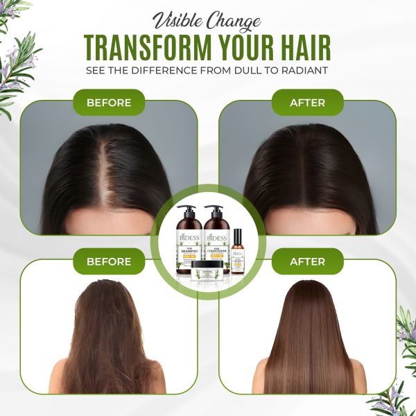 Bidess Hair Care Set – Rosemary & Mint | Shampoo + Conditioner + Hair Mask + Serum | Stimulates Growth, Reduces Hair Loss & Nourishes | Natural Botanical Formula - Image 2